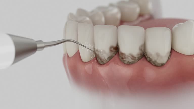 Reliable Dental contractor in Egan, LA by Dentist Open Now